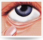 頭仰后，用食指將下眼瞼下拉，使其成袋狀