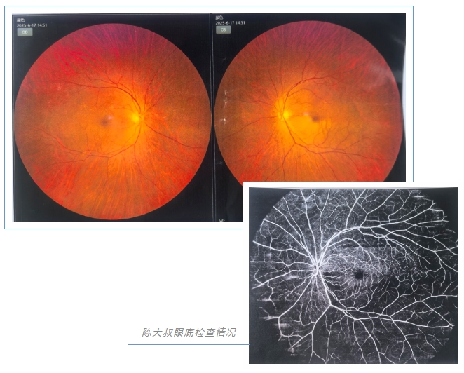 視網(wǎng)膜動(dòng)脈阻塞